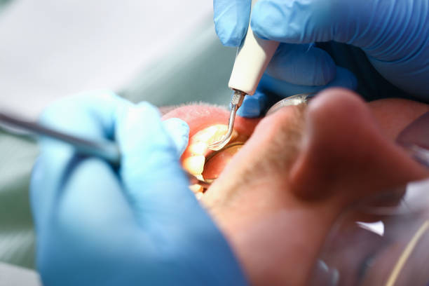 Best Emergency Gum Treatment in South Windham, CT