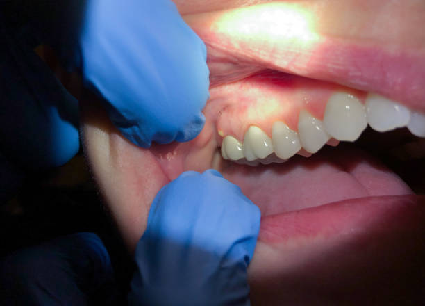 Best Emergency TMJ Treatment in South Windham, CT